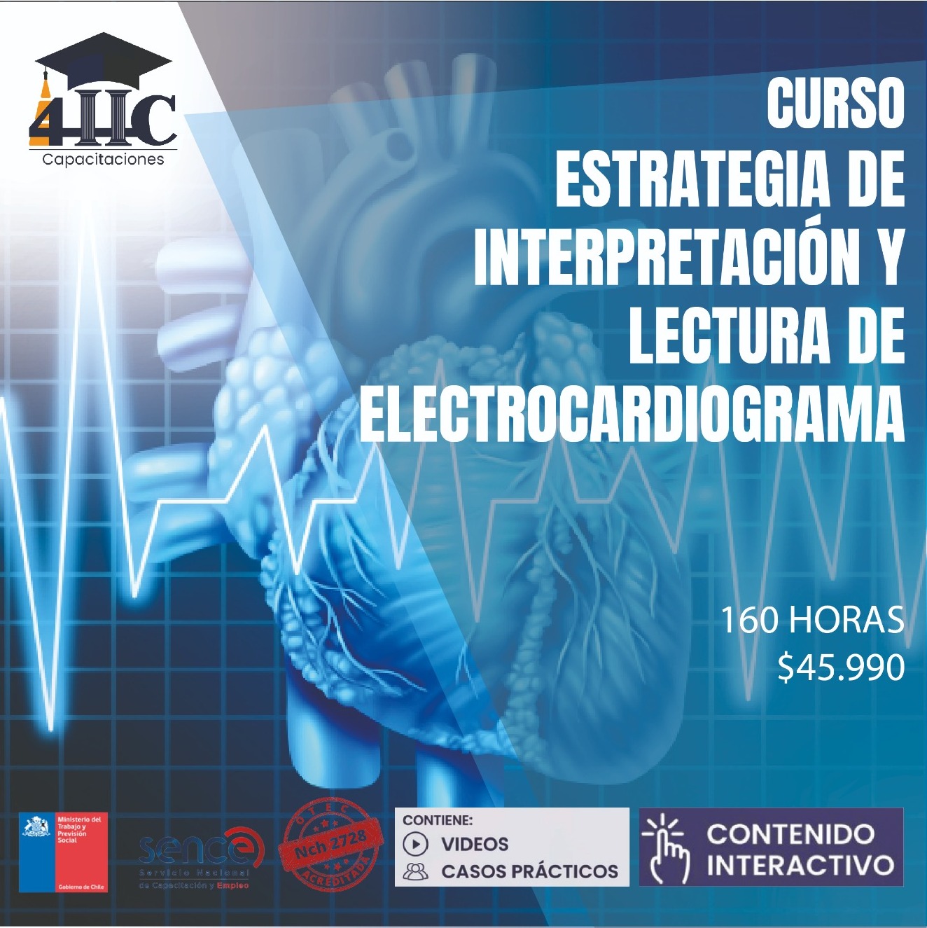 interpretación del electrocardiograma